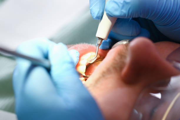 Best Emergency Denture Repair in Merrillville, IN